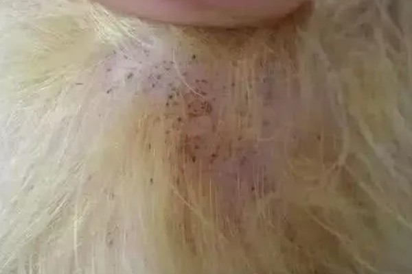 狗狗身上出现跳蚤如何处理,选择专用沐浴露为它洗澡可以杀虫